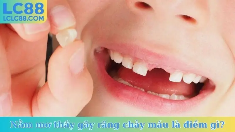 Nằm mơ thấy gãy răng chảy máu là điềm gì?